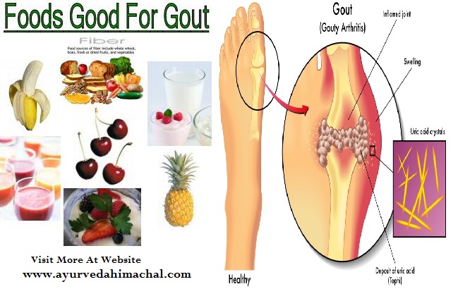 food-good-for-gout.jpg