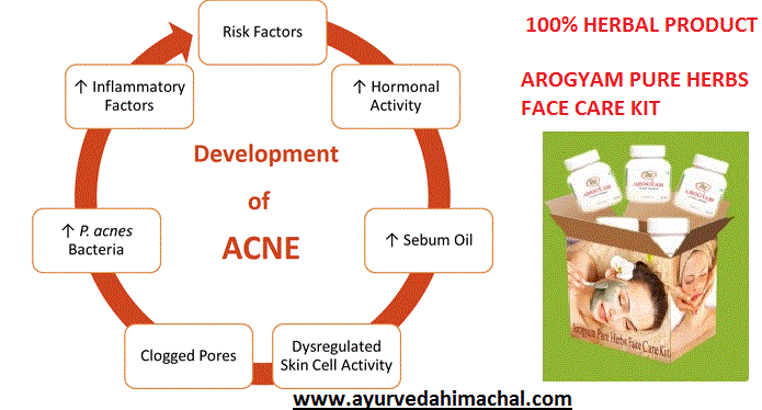acne_development.gif