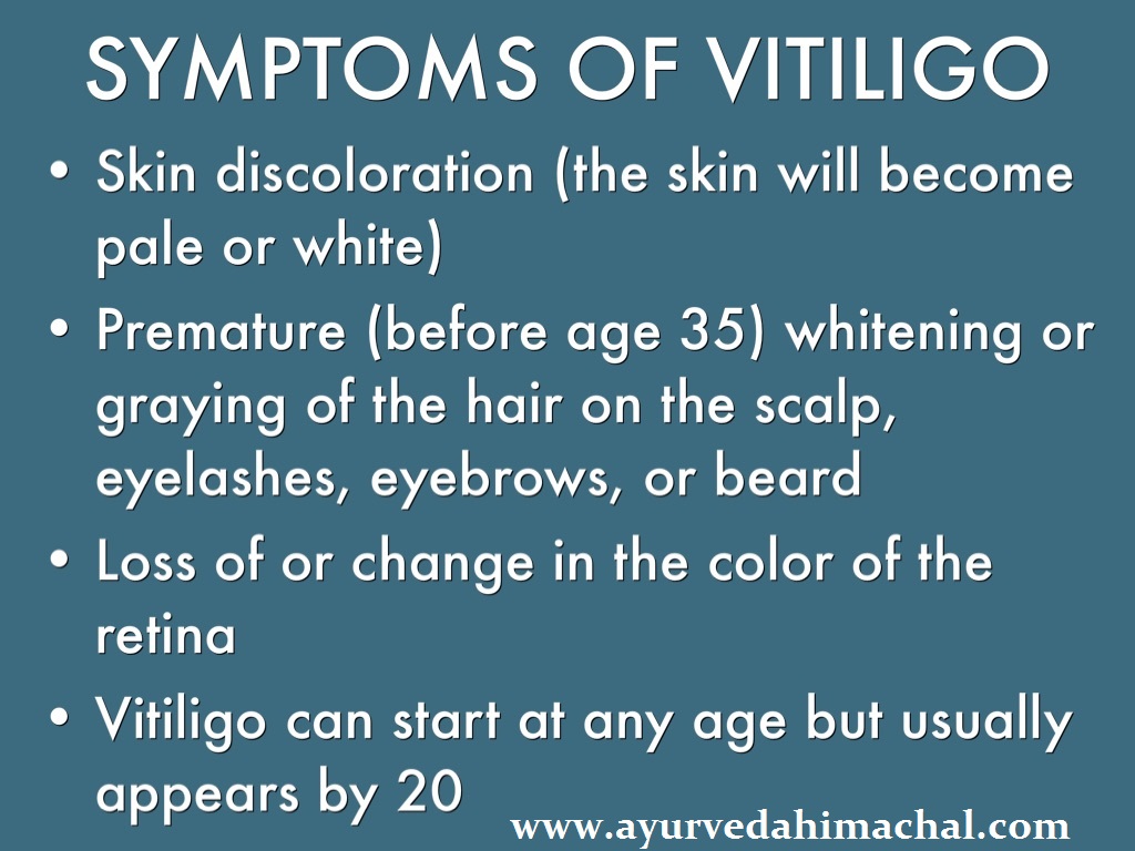 vitiligo causes.jpg
