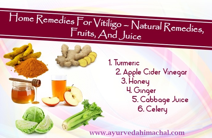 vitiligoremedies.jpg vitiligoremedies.jpg