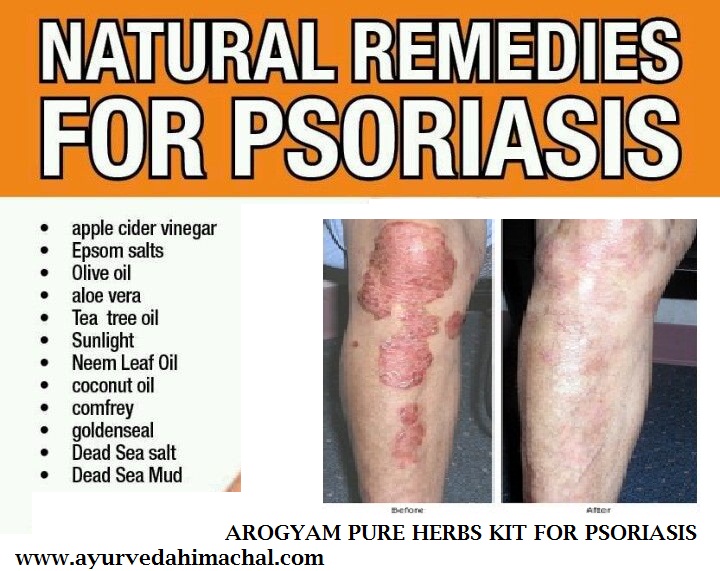 psoriasis.jpg