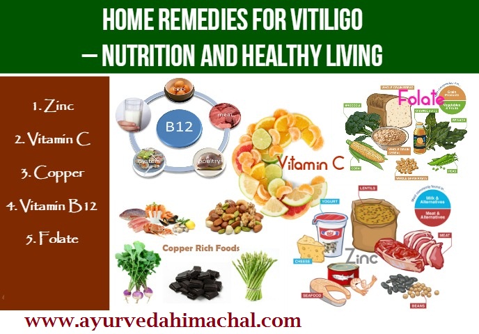 home-remedies-for-vitiligo..jpg