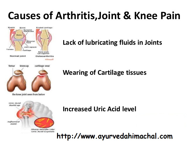 natural-treatment-for-arthiritis..jpg