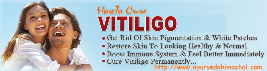 vitiligotretment.jpg