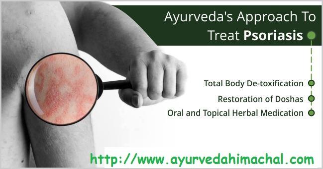 Psoriasis-Treatment...jpg