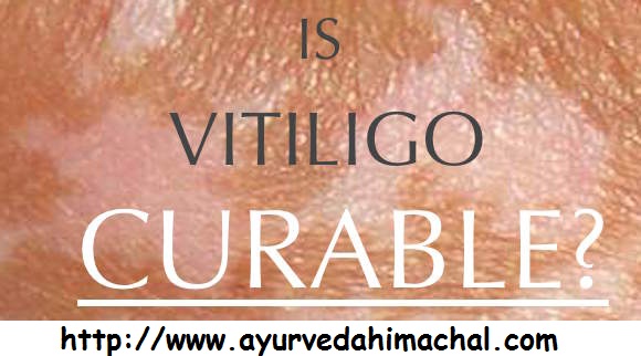 Ayurveda-Vitiligo-cure.jpg Ayurveda-Vitiligo-cure.jpg