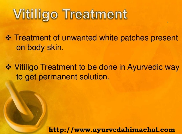 vitiligo-treatment.jpg