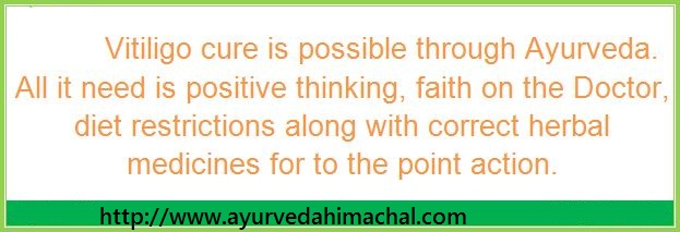 Vitiligo Treatment.JPG