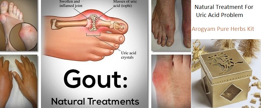 gout-remedies.jpg