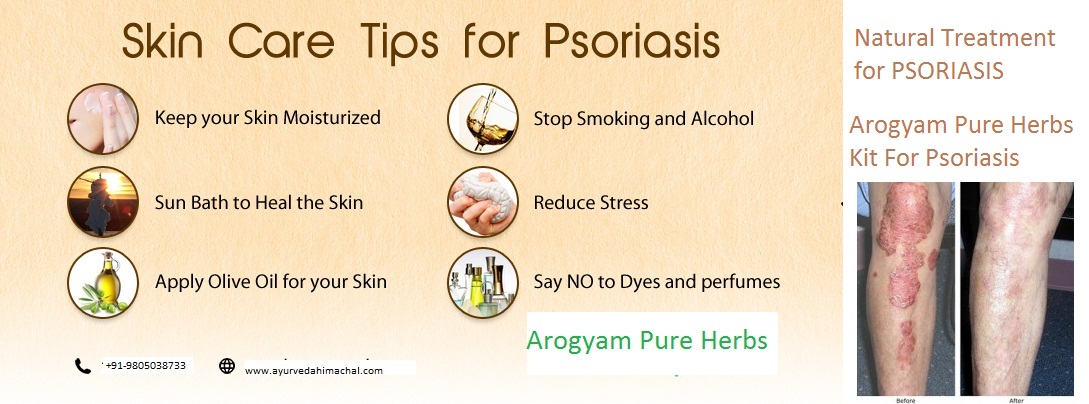 Skin-Care-Tips-for-Psoriasis-copy.jpg