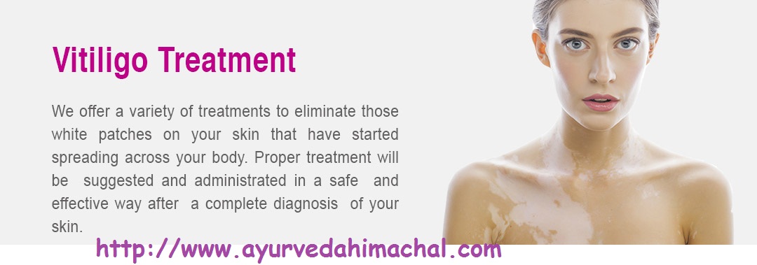 Vitiligoayurveda.jpg Vitiligoayurveda.jpg