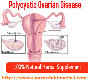 pcodayurvedictreatment.png pcodayurvedictreatment.png